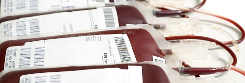 Older Blood Used In Transfusions May Be Harmful To Adult Sickle Cell Patients, Review Finds 