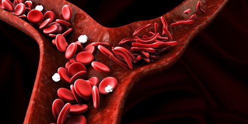 Prolong Pharma’s Sanguinate Shows Promise In Reverting Shape Of Red Blood Cells In SCD 