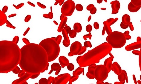 ‘Natural’ Gene Mutation May Offer Way Of Treating Sickle Cell Disease, Study Says 